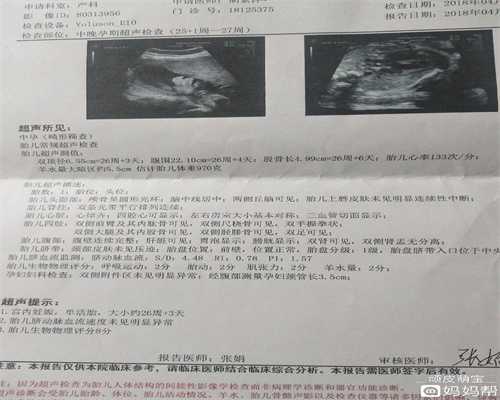 上海地下代孕市场代代孕期间夫妻可以同房吗？