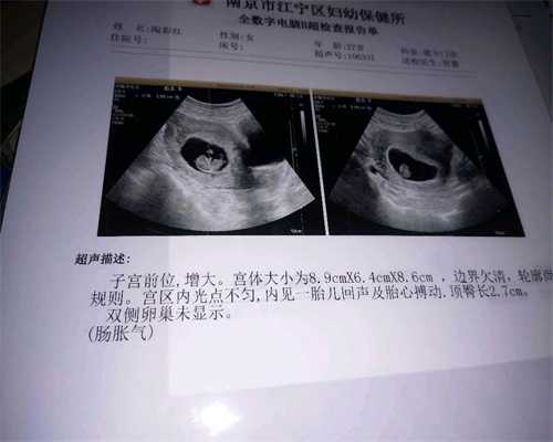 上海正规代孕招聘代怀孕中期就舒服了？想要代