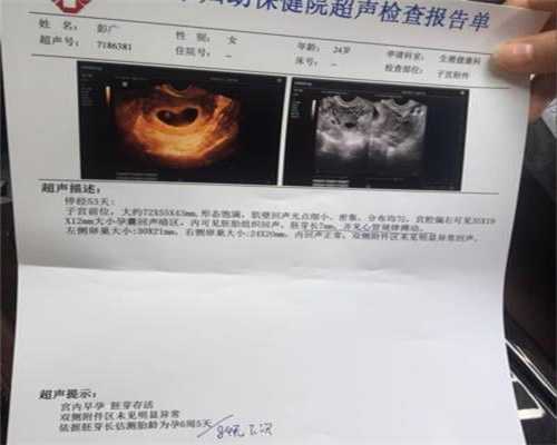 代孕需要多大年龄：上海代孕哪家专业：代孕多