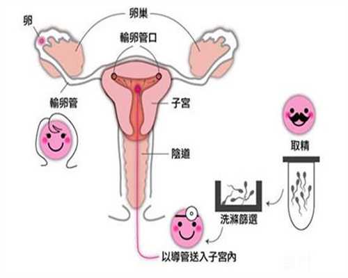 上海代孕价格-代怀孕小孩中耳炎吃什么药