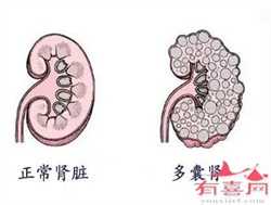 上海助孕到底为哪般，上海国妇婴一代试管助孕成功率是多少？